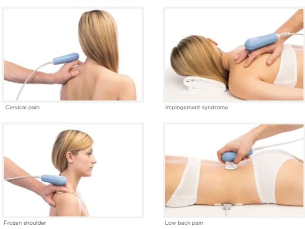 TECAR Therapy
